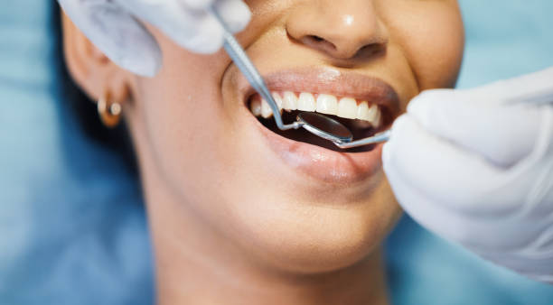 Best Emergency Tooth Extraction in Central, LA